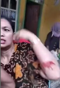 Anak Kandung Aniaya Ibu Gara-gara Tak Diberi Uang