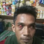 Dua Orang Warga Mersam, Di Aniaya Karyawan PT DMP Hingga Babak Belur 